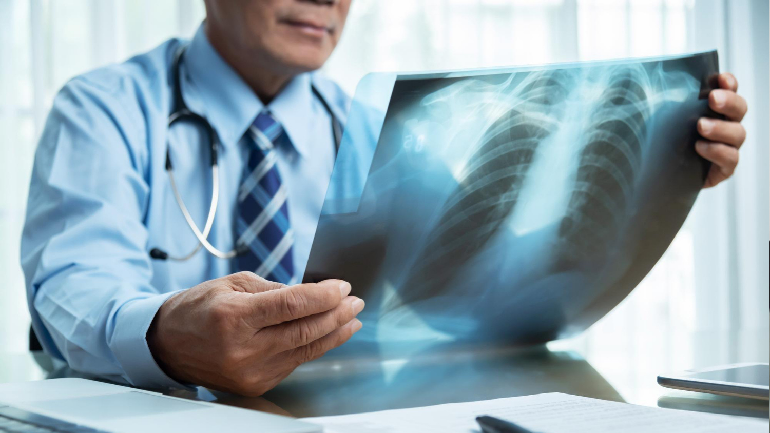 Pulmonary Test Image